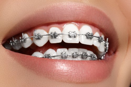 Orthodontics ID:9